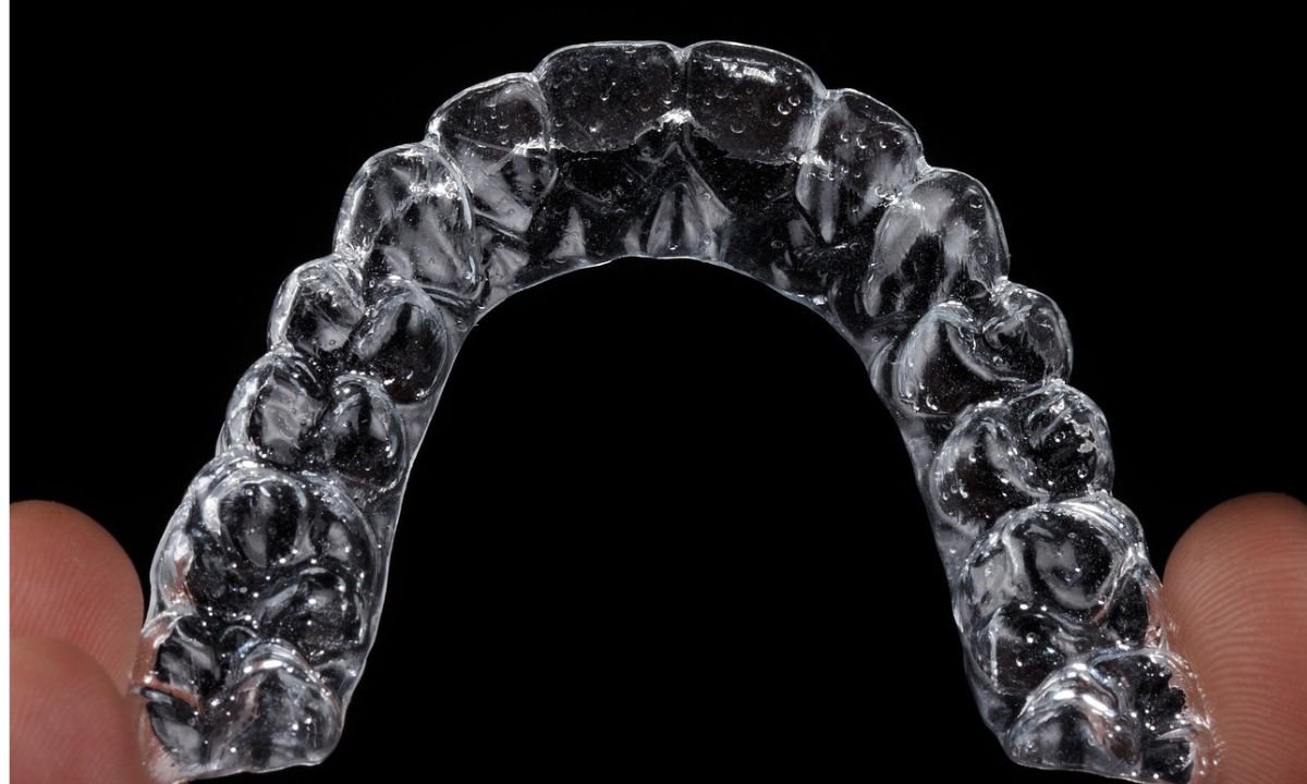 Invisalign Technology